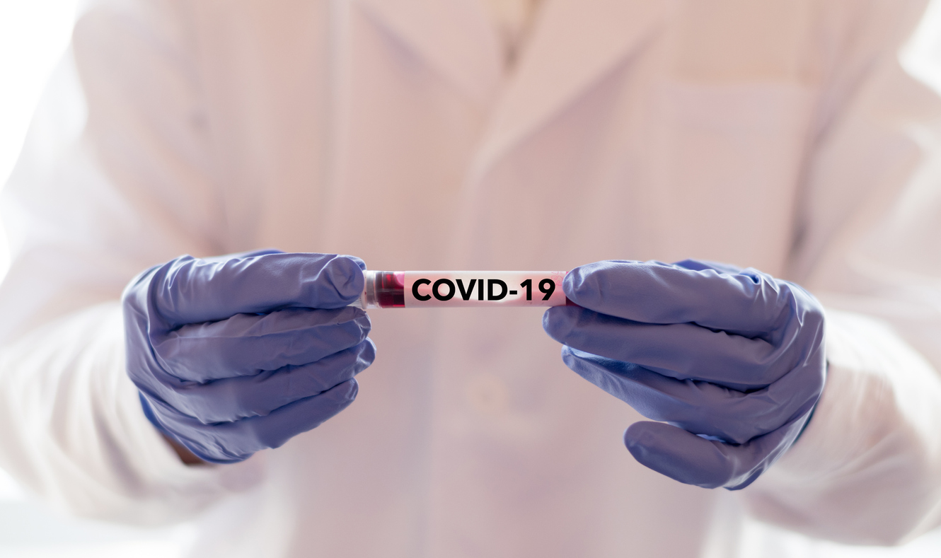 Doctor holding blood sample with novel coronavirus