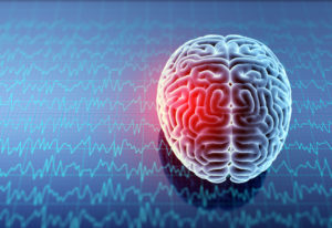 Headache area on brain X-ray, 3D illustration.