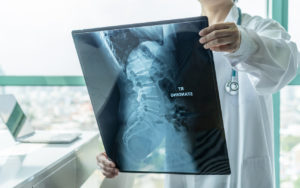xray