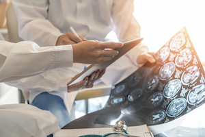 Brain Injuries are a Serious Medical Condition