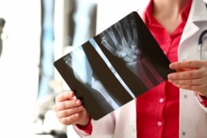 Evidence in a Personal Injury Claim