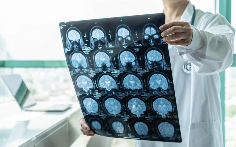 Brain disease diagnosis with medical doctor seeing.